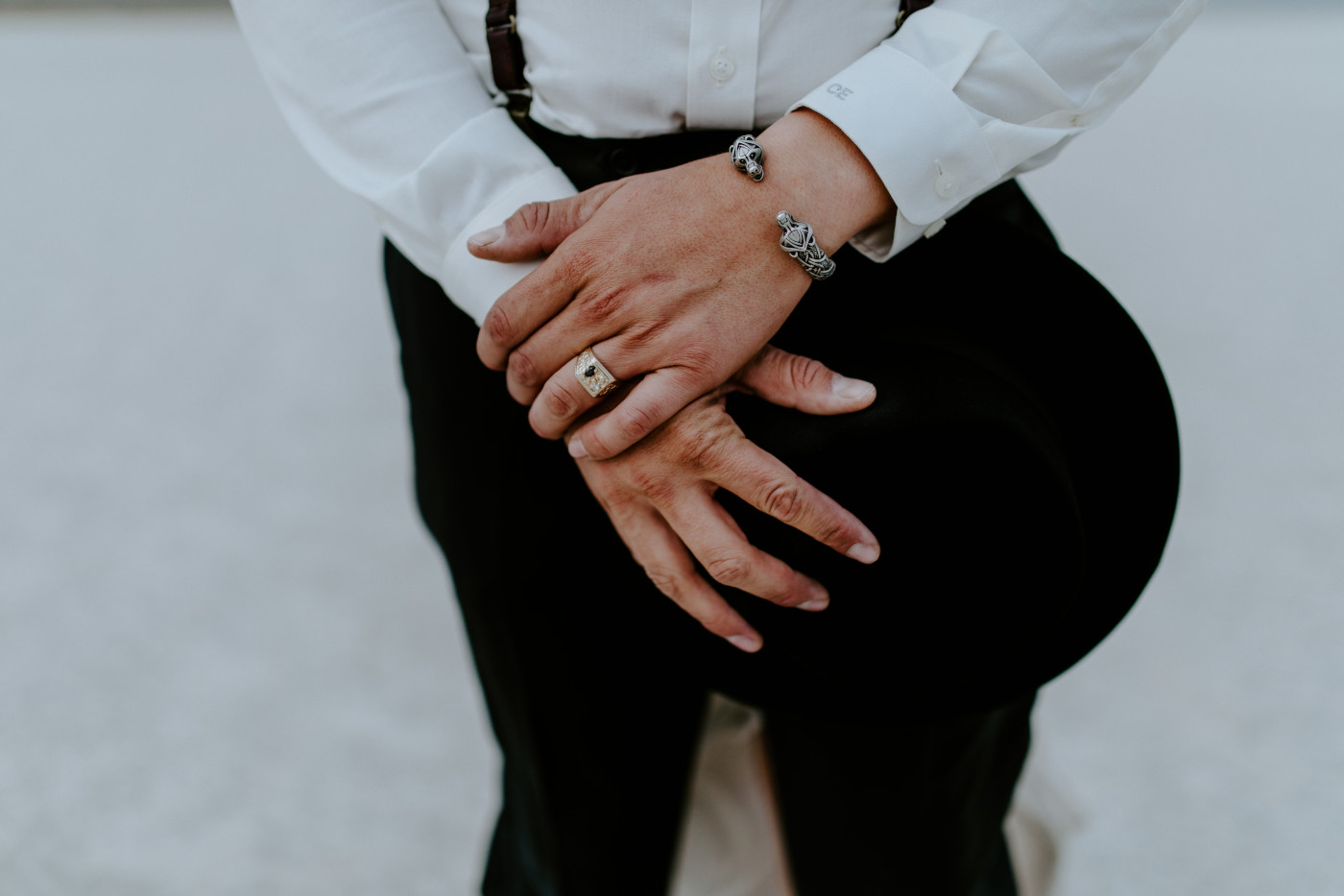 A close up of Cameron's ring and hands.